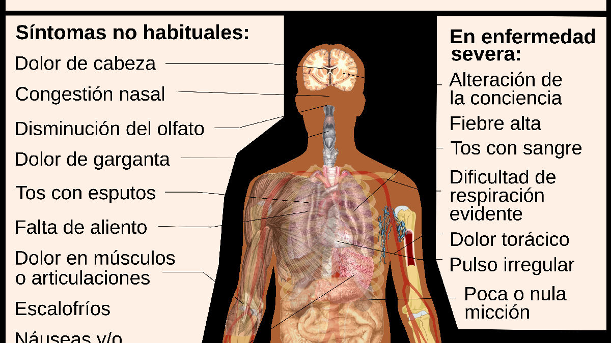 Wikipedia / COVID-19 (es)